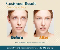 Beauty Skincare Before After Facebook Post