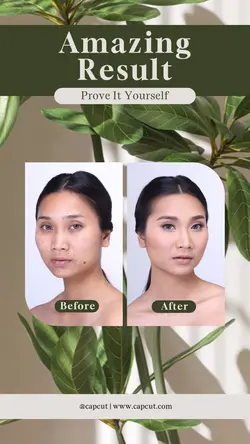 Skincare Result Instagram Story Post Nature Tone 