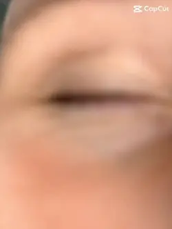 Eye 👁️