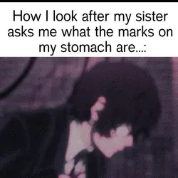 Stretch marks