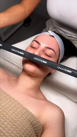 Microneedling