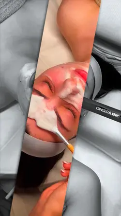Microneedling