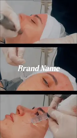 Microneedling aesthe