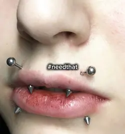 angel bites