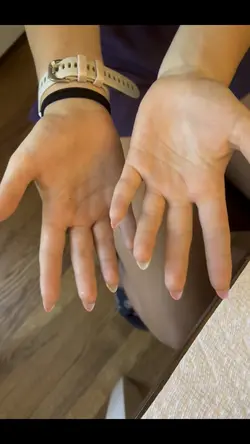 Nail transition!