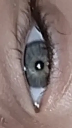 EYES*