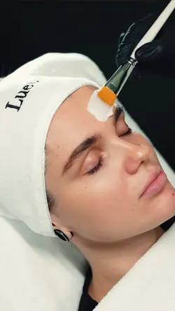 Microneedling aesthe