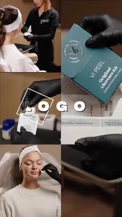 Microneedling