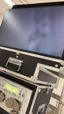 Endoscopia de Coluna
