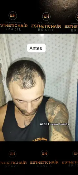 camadas música 