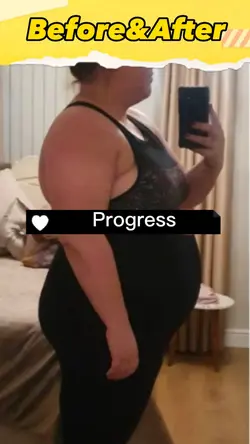 Before&After