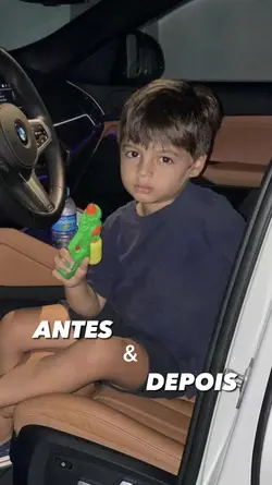 ANTES x DEPOIS