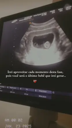 Meu último bebê 