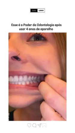 Aparelha dentária 🎯
