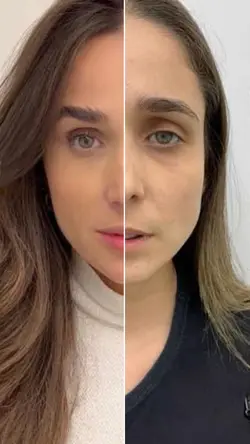 Transição antes 