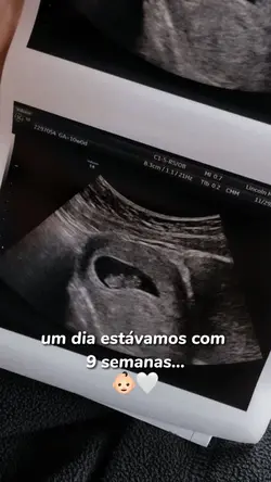 texto EDITÁVEL 👶🏻❤️‍🩹
