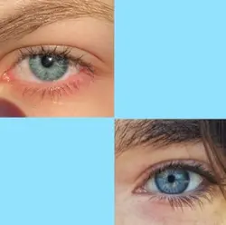 Blue Eye x Hazel Eye