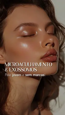 Microagulhamento