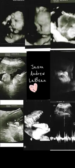 pregnancy template 