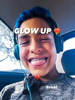 GLOW UP TREND