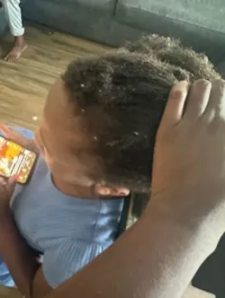 Shrinkage is Real 