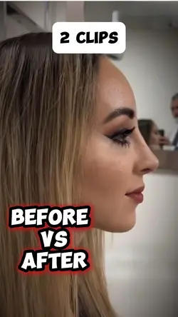 Before vs Afte