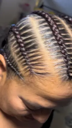 Braids 