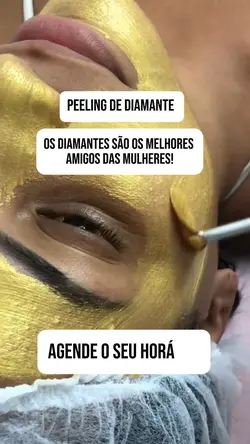 Peeling de Diamante 