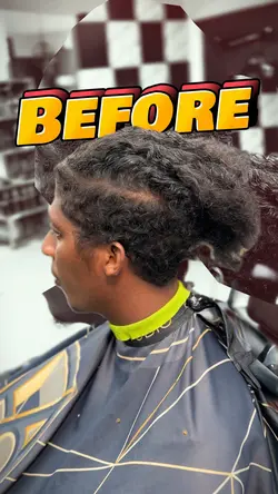 Before And After