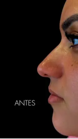 Estética