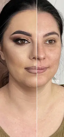 Antes e depois 