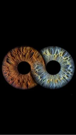 Blue and brown eyes.