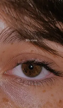 Eye freckles😍