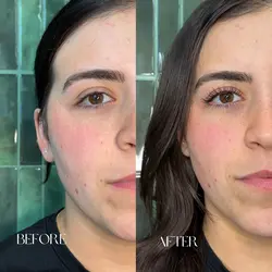 Before and after