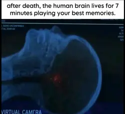 After death