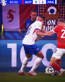 Mbappe Broken nose.