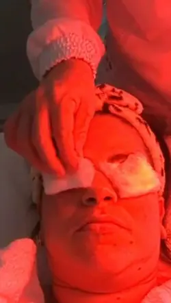 Pele de porcelana 