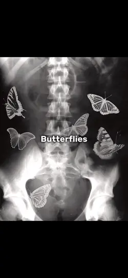 Butterflies 🫶🏼. 