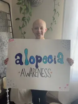 Alopecia awareness 