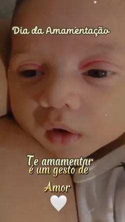 Dia da Amamentação 🤍