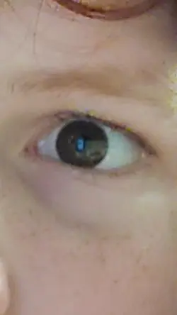 eye transition 