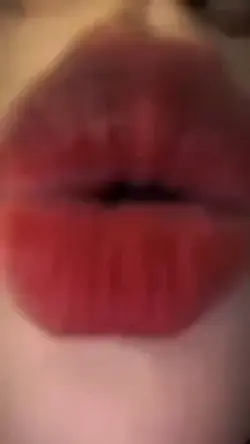 Kiss