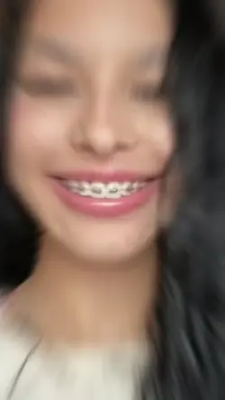 tirou o aparelho
