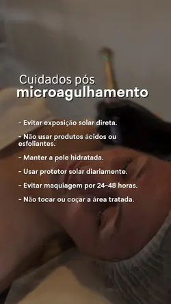 Microagulhamento 
