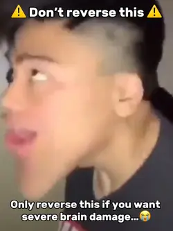 Brain Damag