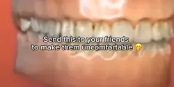 Teeth inhaling