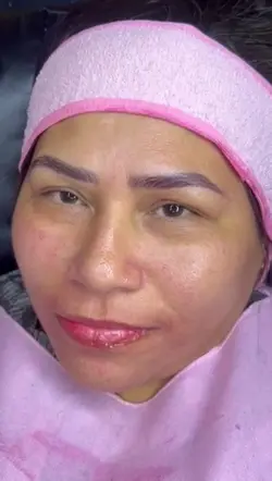 limpeza de pele 