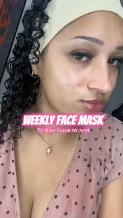 🎀