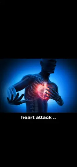 heart attack