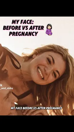 Before vs After🤰🏻